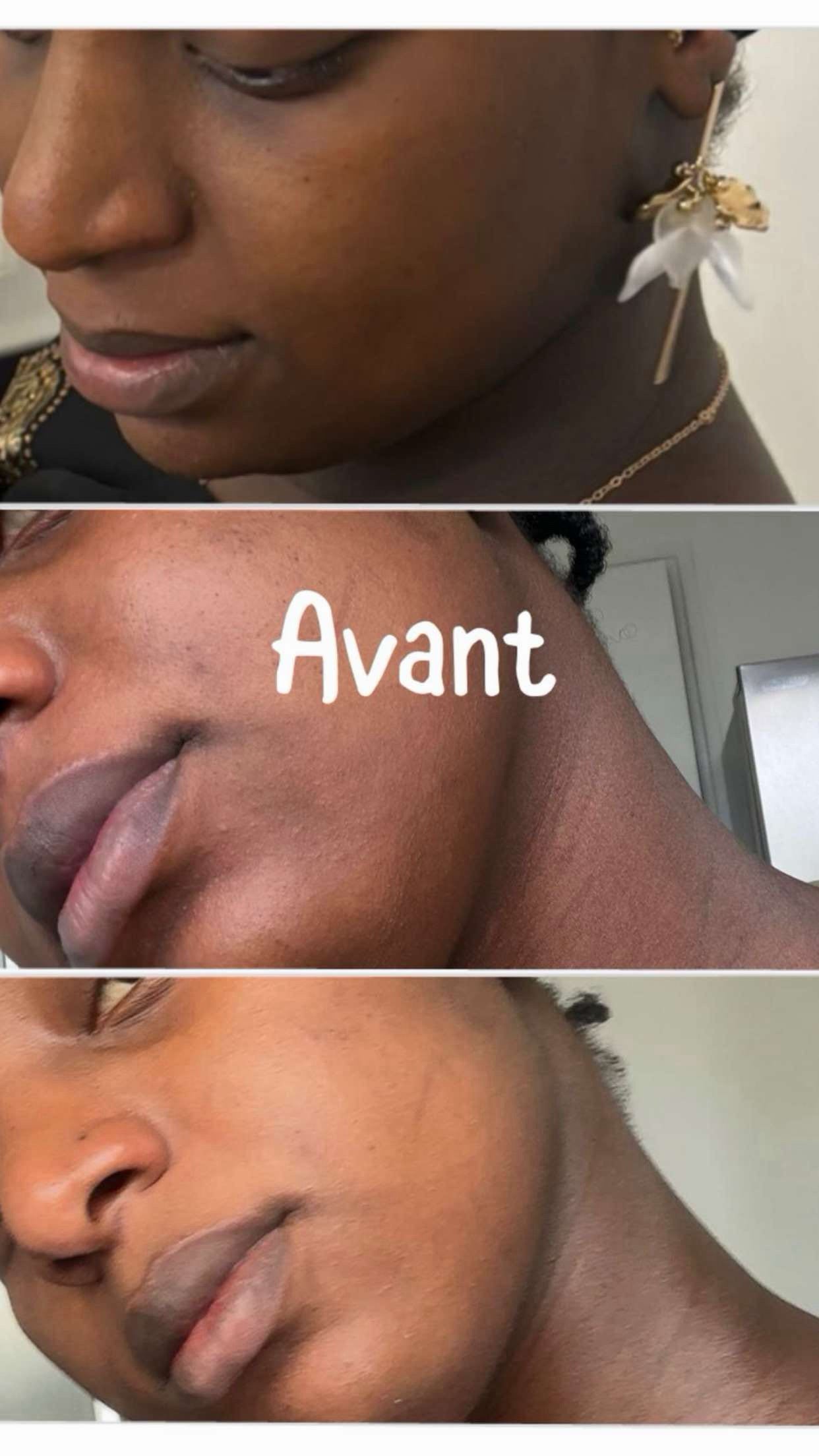 Kit Visage Kojie San – Routine Complète Éclat & Uniformité